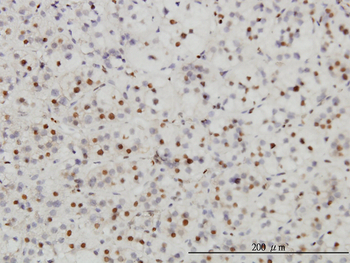 SAE1 monoclonal antibody (M01), clone 1G4-1G5