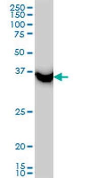 SAE1 monoclonal antibody (M01), clone 1G4-1G5