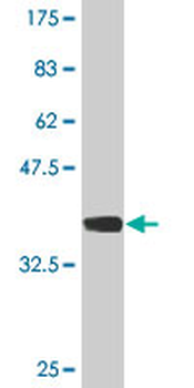 SPAG6 monoclonal antibody (M01), clone 3E3