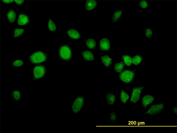 USP14 monoclonal antibody (M04), clone 6D6