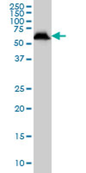 USP14 monoclonal antibody (M04), clone 6D6