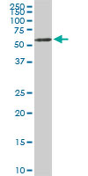 USP14 monoclonal antibody (M04), clone 6D6