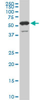 USP14 monoclonal antibody (M04), clone 6D6