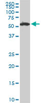 USP14 monoclonal antibody (M04), clone 6D6