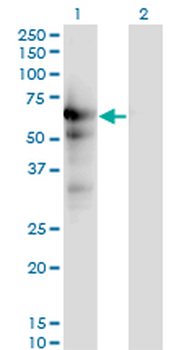 USP14 monoclonal antibody (M04), clone 6D6