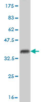 USP14 monoclonal antibody (M04), clone 6D6