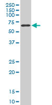 TBX18 monoclonal antibody (M06), clone 4D3