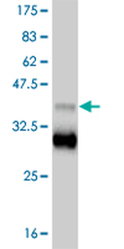 TBX18 monoclonal antibody (M06), clone 4D3