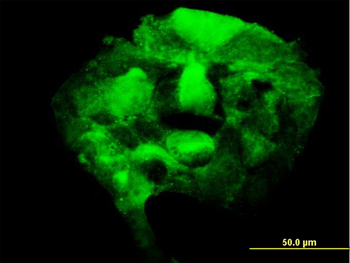 PAPSS2 monoclonal antibody (M07), clone 2A8