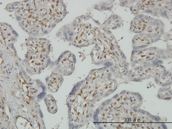 PAPSS2 monoclonal antibody (M07), clone 2A8