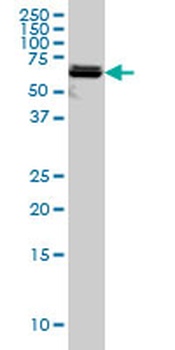 PAPSS2 monoclonal antibody (M07), clone 2A8