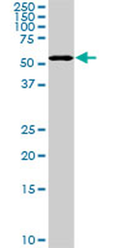 PAPSS2 monoclonal antibody (M07), clone 2A8