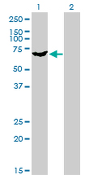 PAPSS2 monoclonal antibody (M07), clone 2A8