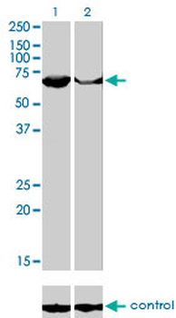 PAPSS2 monoclonal antibody (M07), clone 2A8