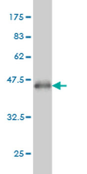 PAPSS2 monoclonal antibody (M07), clone 2A8