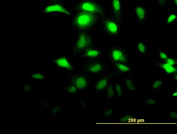 CLIC3 monoclonal antibody (M02), clone 3F8