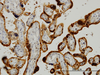 CLIC3 monoclonal antibody (M02), clone 3F8