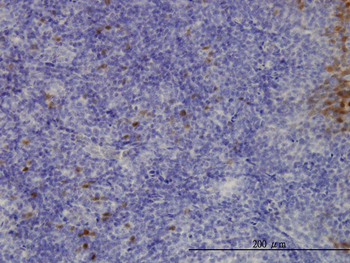 CLIC3 monoclonal antibody (M02), clone 3F8