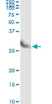 CLIC3 monoclonal antibody (M02), clone 3F8