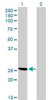 CLIC3 monoclonal antibody (M02), clone 3F8