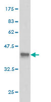 CLIC3 monoclonal antibody (M02), clone 3F8