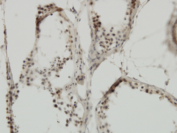 TRIM24 monoclonal antibody (M01), clone 2F2