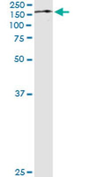 TRIM24 monoclonal antibody (M01), clone 2F2