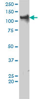 TRIM24 monoclonal antibody (M01), clone 2F2