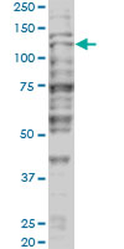 TRIM24 monoclonal antibody (M01), clone 2F2