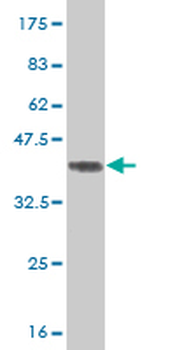 TRIM24 monoclonal antibody (M01), clone 2F2