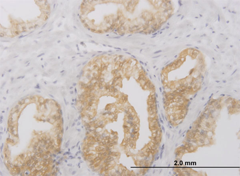 RIPK2 monoclonal antibody (M02), clone 6F7