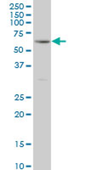 RIPK2 monoclonal antibody (M02), clone 6F7