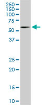 RIPK2 monoclonal antibody (M02), clone 6F7