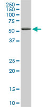 RIPK2 monoclonal antibody (M02), clone 6F7