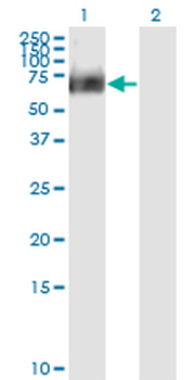 RIPK2 monoclonal antibody (M02), clone 6F7