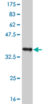 RIPK2 monoclonal antibody (M02), clone 6F7