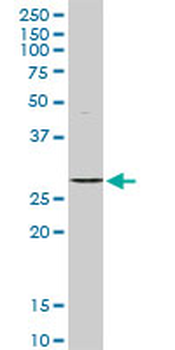 STK16 MaxPab rabbit polyclonal antibody (D01)