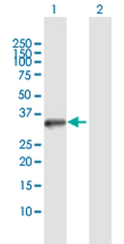 STK16 MaxPab rabbit polyclonal antibody (D01)