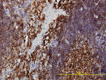 PRKRA monoclonal antibody (M01), clone 1B9-1A7