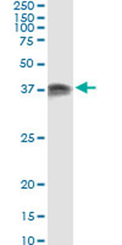 PRKRA monoclonal antibody (M01), clone 1B9-1A7