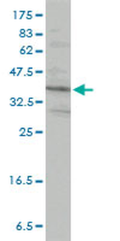 PRKRA monoclonal antibody (M01), clone 1B9-1A7