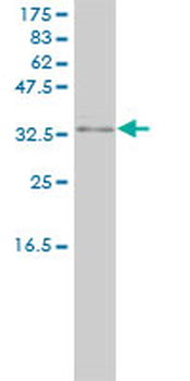 PRKRA monoclonal antibody (M01), clone 1B9-1A7