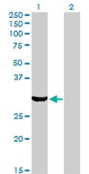 PRKRA monoclonal antibody (M01), clone 1B9-1A7