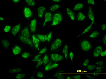 NCOA4 monoclonal antibody (M05), clone 1F11