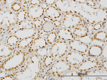 NCOA4 monoclonal antibody (M05), clone 1F11