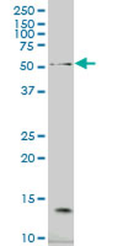 NCOA4 monoclonal antibody (M05), clone 1F11