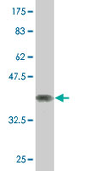 NCOA4 monoclonal antibody (M05), clone 1F11