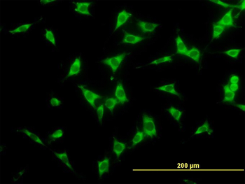 NCOA4 monoclonal antibody (M04), clone 1B7