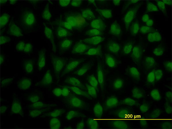 YY1 monoclonal antibody (M02), clone 4A5