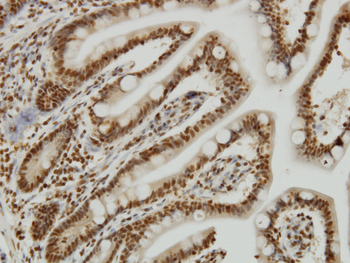 YY1 monoclonal antibody (M02), clone 4A5